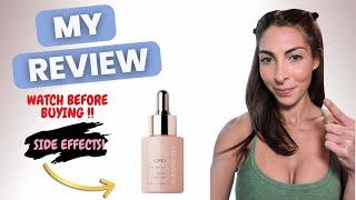 Honest Review! Watch Before Buying Side Effects of hair serum