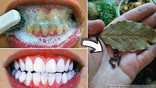Secret that Dentists don't want you to know: Remove Tartar and Teeth Whitening in just 2 minutes