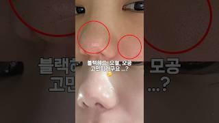 피부과 안가도 되는 블랙헤드 박멸법? #모공관리 #마몽드 #올리브영 #세안법 #클렌징밤