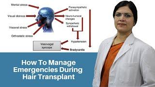 How To Manage Emergencies During Hair Transplant - Dr. Seema Garg | Haircon 2021