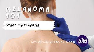 What is Stage II Melanoma?