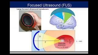 Webinar: Elisa Konofagou, PhD - Focused Ultrasound for Parkinson’s Disease in Preclinical Models