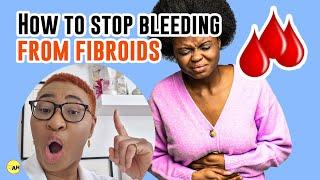 Say GOODBYE to Fibroid Bleeding with these Proven Methods