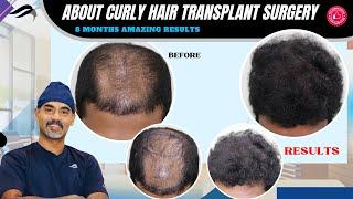 Hair Transplant In Chennai | Best Results Surgeon Cost & Clinic Of Hair Transplant Of Chennai
