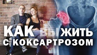 КОКСАРТРОЗ. МОЖНО ЛИ ИЗБЕЖАТЬ ОПЕРАЦИИ?