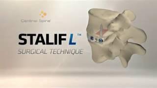 Centinel Spine: STALIF L Surgical Technique