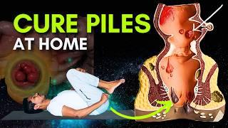 Piles Problem Treatment Part 1 | Yoga for Piles | Cure Hemorrhoids with Simple Exercises #piles