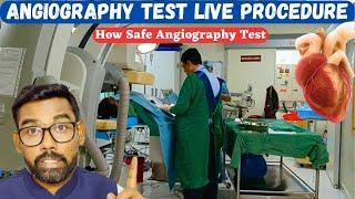 Unbelievable Live Angiography | Angiography Video | Angiogram