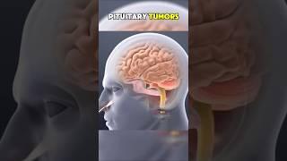 3DTHERAPY VOL-3 #healing #dentist #health #facts #selfcare #doctor #therapy #therapyvideos #tumors