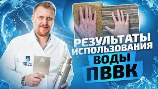 Как вода ПВВК изменила жизнь наших клиентов. Отзывы клиентов о ПВВК