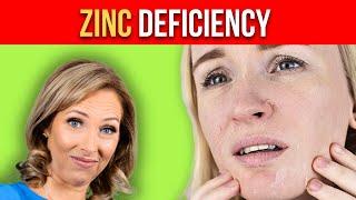 Zinc Deficiency Symptoms | Dr. Janine