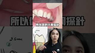 你有牙周病嗎？一個簡單工具就可判斷#牙齦炎#牙周病