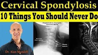 CERVICAL SPONDYLOSIS 10 Things You Should Never Do -  Dr. Alan Mandell, DC