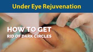 Under Eye Rejuvenation | Dr. Jyoti Gupta MD