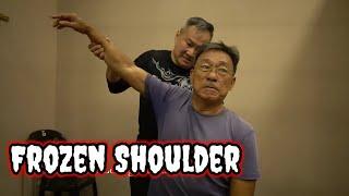 Frozen Shoulder Before and After the Clm Tit Tar Treatment result done by Master Chris Leong