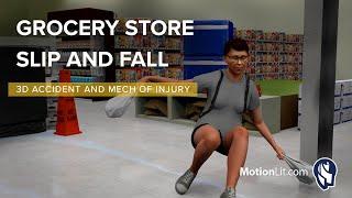 Customer Sustains Cervical Injuries In Grocery Store Slip and Fall