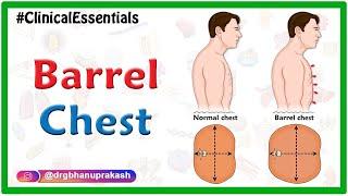 Barrel chest : Clinical essentials