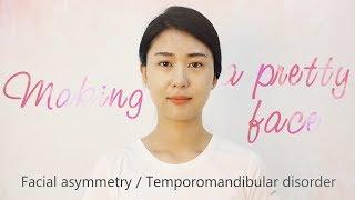 making a pretty face (Facial asymmetry / Temporomandibular disorder)