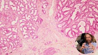 Histology of the prostate and seminal vesicles