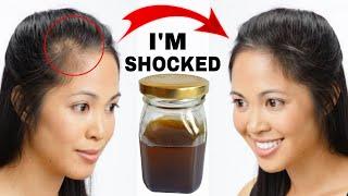 Hair Tonic To Increase Thickness And Volume Of Your Hair Naturally