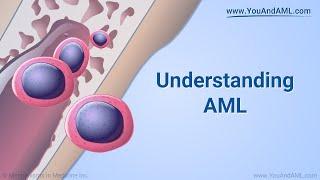 Understanding AML