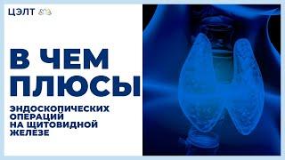  В чем плюсы эндоскопических операций на щитовидной железе. Эндоскопическая операция щитовидки.12+