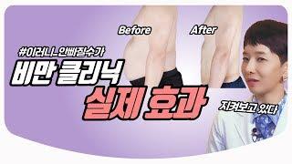 비만 클리닉 다이어트 효과 & 실제 후기 & 방법 | 가정의학과 의사친 고정아