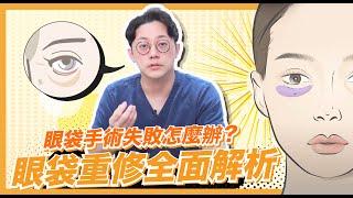 眼袋手術失敗怎麼辦！「眼袋重修」全面解析｜周杰醫師