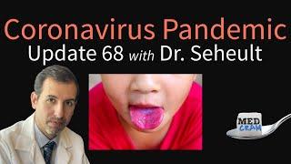 Coronavirus Pandemic Update 68: Kawasaki Disease; Minority Groups & COVID-19