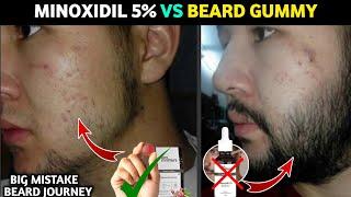 Minoxidil 5% vs beard gummy | man matters beard gummies review | man matters beard oil review |