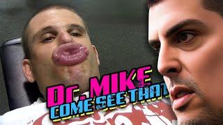 Jason Genova needs more skittles - The Busted Lips Situation!