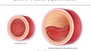 Ventilation, Perfusion & Shock