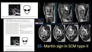 SIGNS IN RADIOLOGY-SET IV