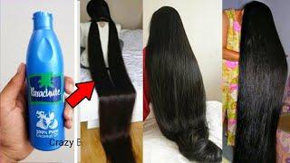 Add 2 Things With Coconut Oil & Get Long and Thicken Hair Faster !! Super Fast Hair Growth Challenge