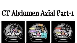 CT Scan of abdomen part 1