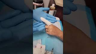 How To: Best Practice Finger Laceration Wound Dressing