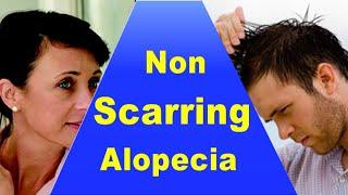 Non Scarring Alopecia || नॉन स्कारिंग एलोपेशिया || डॉ मुकेश अग्रवाल ||