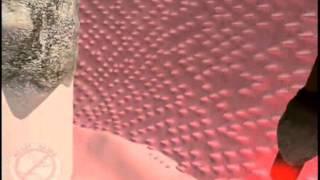 Periodontist Dr. Thomas McCawley Narrating LANAP Procedure Animation in Fort Lauderdale, FL