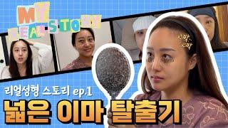 이마 축소 & 거상 리얼성형 스토리 EP.1ㅣ수술 전 과정 공개!