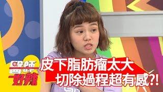 陳彥婷皮下脂肪瘤太大？切除過程超有感？【醫師好辣】 20190722  part3  EP778 鄭丞傑 陳彥婷