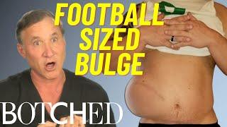 Wesley Looks Like He “Swallowed A Football” FULL TRANSFORMATION | Botched | E!