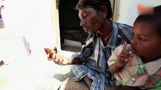 Man Addicted To Eating Bricks, Mud and Gravel (India)