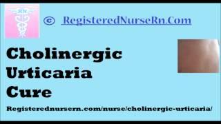 Cholinergic Urticaria Cure