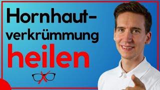 HORNHAUTVERKRÜMMUNG - Ursachen, Symptome, Behandlung - Sehen ohne Brille durch Augentraining