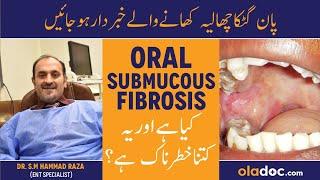 Oral Submucous Fibrosis Causes Treatment - Paan Chaliya Khane Ke Nuksan - Mun Ka Kam Khulna Ka Ilaj