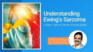 Understanding Ewing's Sarcoma :  A Rare Type of Cancer Among Adults