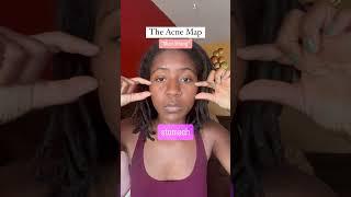 ACNE MAPPING #chinesemedicine #facemapping #acnetips #holisticskincare