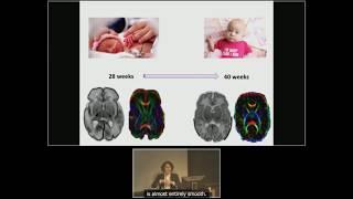 Dawn Gano: "Little brain" health in preterm newborns