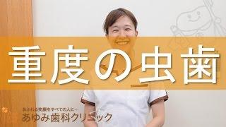 松井山手・京田辺・くずはで口コミで評判の歯医者さん　~重度の虫歯~