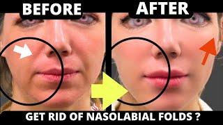  FACE YOGA FOR NASOLABIAL FOLDS | EFFECTIVE FACE EXERCISES for LAUGH LINES, JOWLS, FOREHEAD, MOUTH